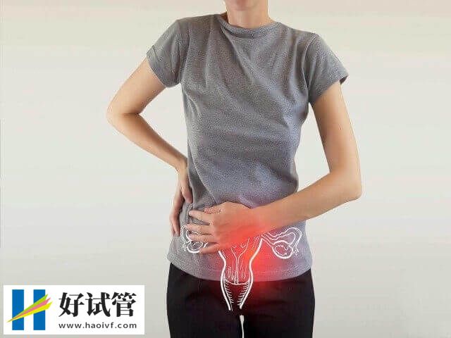 子宫憩室做宫腹腔镜手术多少钱(图1) 子宫憩室做宫腹腔镜手术多少钱(图1)