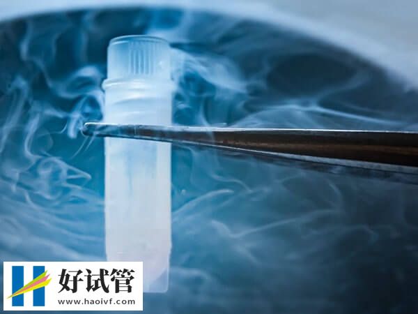 HIV洗精流程是什么(图1) HIV洗精流程是什么(图1)